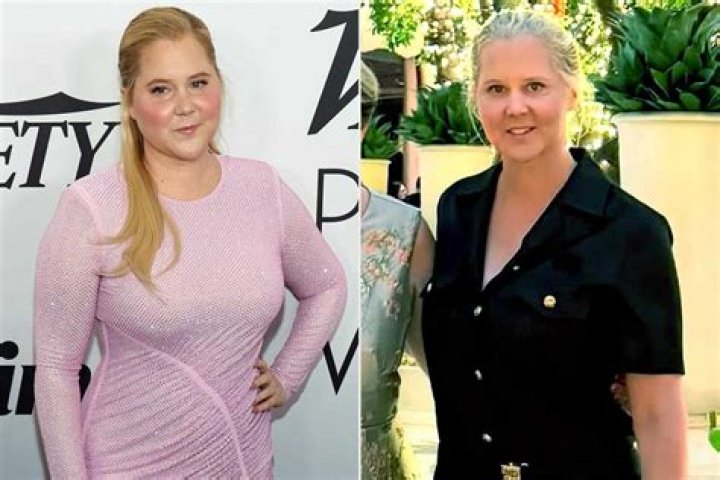 Amy Schumer’s Wife: Who is Amy Schumer Dating?